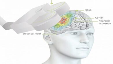 تحریک مغناطیسی مغز یا TMS